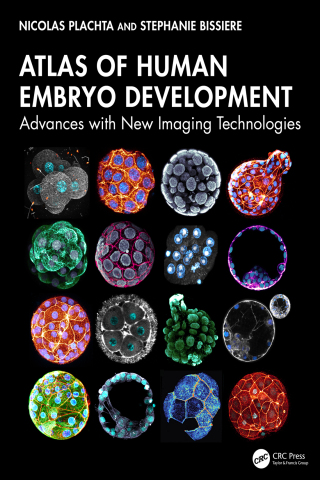 Cover image: Atlas of Human Embryo Development 1st edition 9781032751474