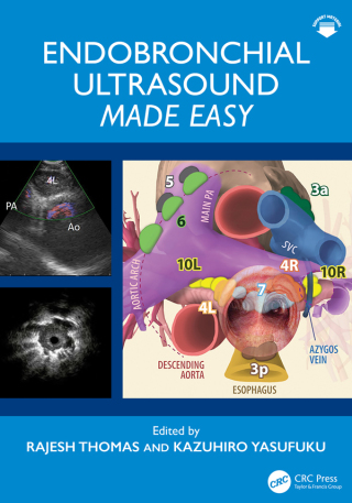 Cover image: Endobronchial Ultrasound Made Easy 1st edition 9780367630768
