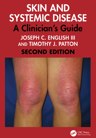 Cover image: Skin and Systemic Disease 2nd edition 9781032762814