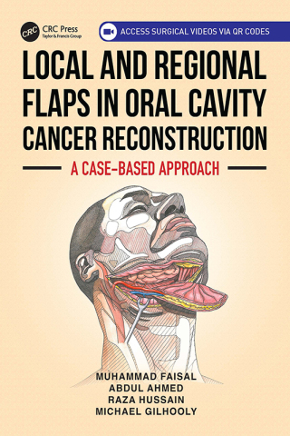表紙画像: Local and Regional Flaps in Oral Cavity Cancer Reconstruction 1st edition 9781032714417