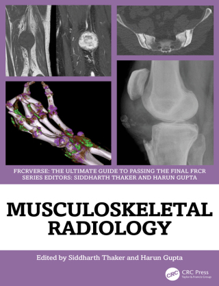 Cover image: Musculoskeletal Radiology 1st edition 9781032815152