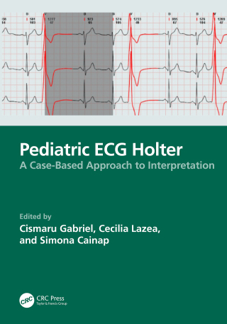 Imagen de portada: Pediatric ECG Holter 1st edition 9781032898711