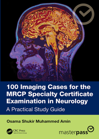 Cover image: 100 Imaging Cases for the MRCP Specialty Certificate Examination in Neurology 1st edition 9781041091516