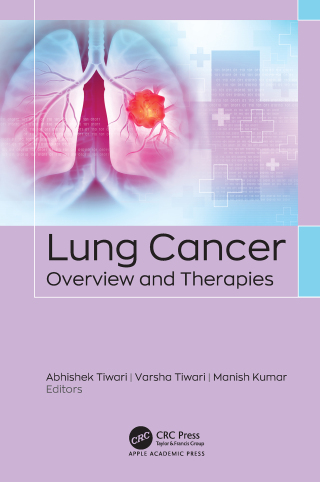 Imagen de portada: Lung Cancer 1st edition 9781779640222