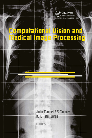 Cover image: Computational Vision and Medical Image Processing 1st edition 9780415457774