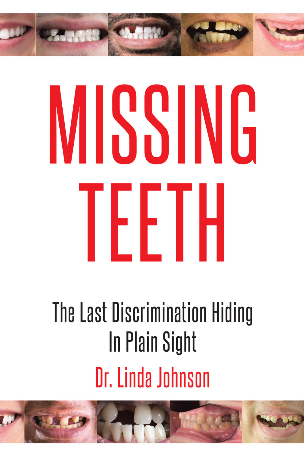 Missing Teeth (eBook)
