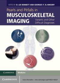 Imagen de portada: Pearls and Pitfalls in Musculoskeletal Imaging 1st edition 9780521196321