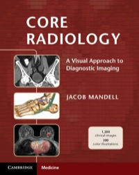 Imagen de portada: Core Radiology 1st edition 9781107679689