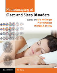 Cover image: Neuroimaging of Sleep and Sleep Disorders 1st edition 9781107018631