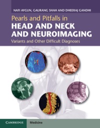 Titelbild: Pearls and Pitfalls in Head and Neck and Neuroimaging 1st edition 9781107026643