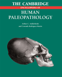 صورة الغلاف: The Cambridge Encyclopedia of Human Paleopathology 9781107403772