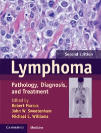 Cover image: Lymphoma 2nd edition 9781107010598