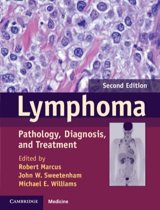 Imagen de portada: Lymphoma 2nd edition 9781107010598