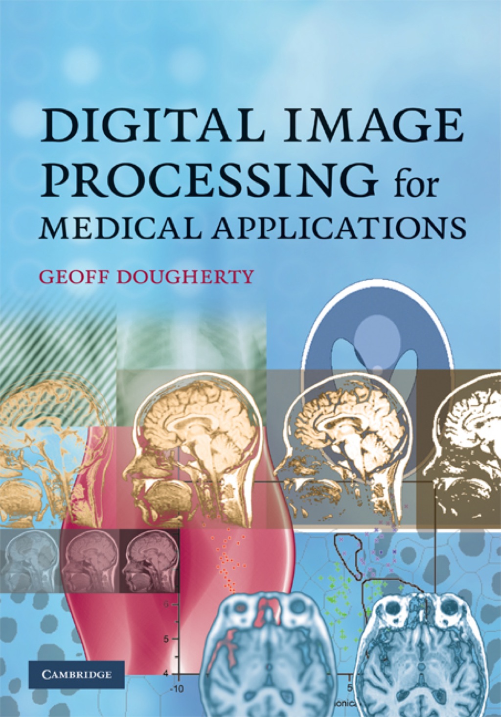 Digital Image Processing for Medical Applications 1st Edition
