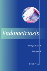 Cover image: Endometriosis 1st edition 9781900364874