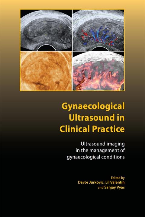 Gynaecological Ultrasound in Clinical Practice, 1st Edition - FULL INSTANT DOWNLOAD | PDF DOCX EPUB