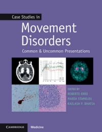 Immagine di copertina: Case Studies in Movement Disorders 9781107472426