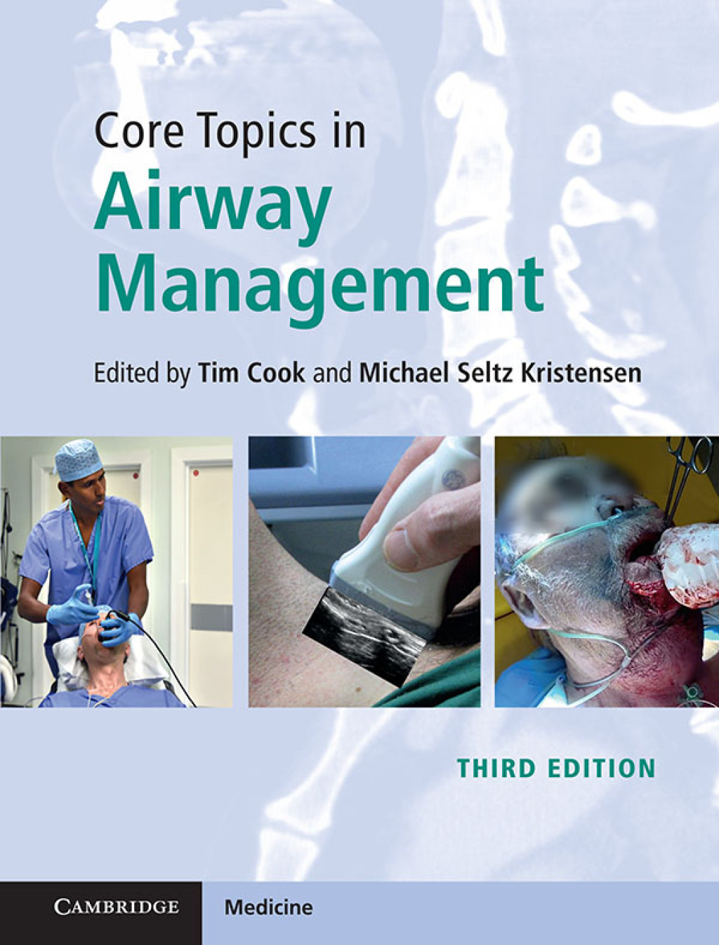 ISBN 9781108419536 product image for Core Topics in Airway Management - 3rd Edition (eBook Rental) | upcitemdb.com