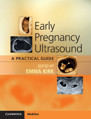 Immagine di copertina: Early Pregnancy Ultrasound 9781316503867