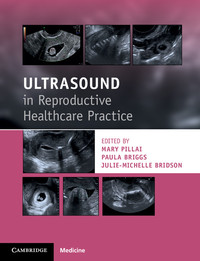 Titelbild: Ultrasound in Reproductive Healthcare Practice 9781316609736