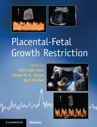 Cover image: Placental-Fetal Growth Restriction 9781107101395