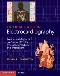 Cover image: Critical Cases in Electrocardiography 9781107535916