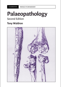 Cover image: Palaeopathology 2nd edition 9781108499583