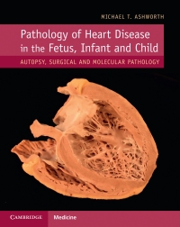 Cover image: Pathology of Heart Disease in the Fetus, Infant and Child 9781107116283