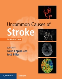 Cover image: Uncommon Causes of Stroke 3rd edition 9781107147447