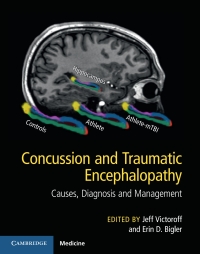 Imagen de portada: Concussion and Traumatic Encephalopathy 9781107073951