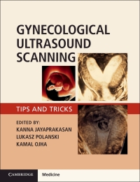 Cover image: Gynaecological Ultrasound Scanning 9781316645178