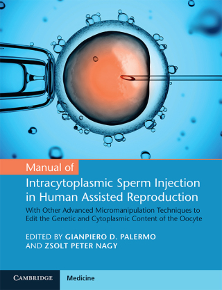 Immagine di copertina: Manual of Intracytoplasmic Sperm Injection in Human Assisted Reproduction 9781108743839