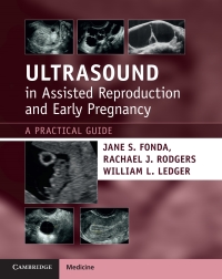صورة الغلاف: Ultrasound in Assisted Reproduction and Early Pregnancy 9781108810210