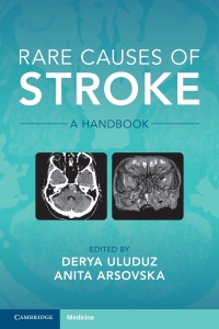 Cover image: Rare Causes of Stroke 9781108821254