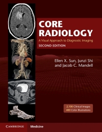 Cover image: Core Radiology 2nd edition 9781108965910