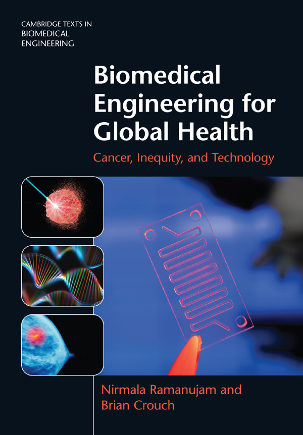 Biomedical Engineering for Global Health Cancer, Inequity, and Technology