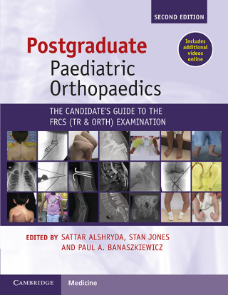 Cover image: Postgraduate Paediatric Orthopaedics 2nd edition 9781108970617