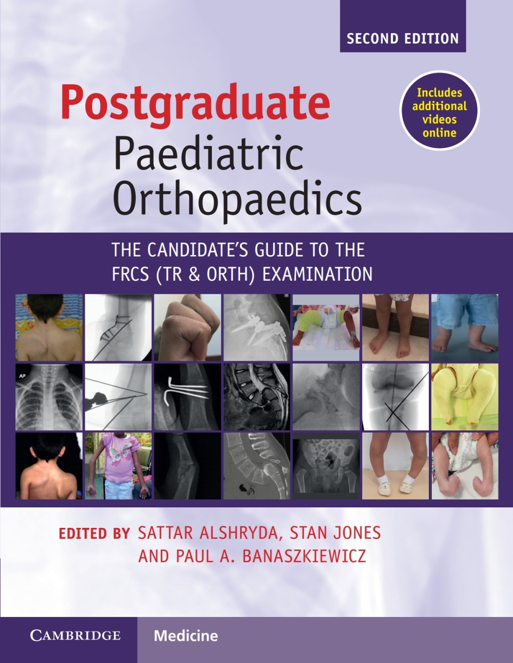 Postgraduate Paediatric Orthopaedics The Candidate’s Guide to the FRCS(Tr&Orth) Examination 2nd Edition
