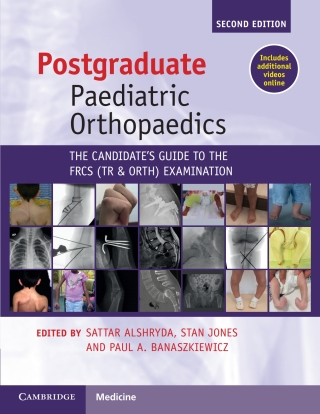 Immagine di copertina: Postgraduate Paediatric Orthopaedics 2nd edition 9781108970617