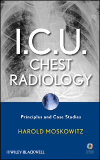 صورة الغلاف: I.C.U. Chest Radiology 1st edition 9780470450345