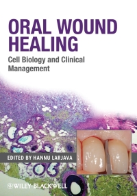 Cover image: Oral Wound Healing 1st edition 9780813804811
