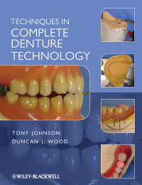 Imagen de portada: Techniques in Complete Denture Technology 1st edition 9781405179096