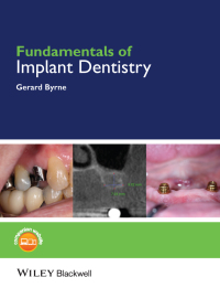 Cover image: Fundamentals of Implant Dentistry 1st edition 9781118274965