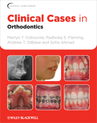 Cover image: Clinical Cases in Orthodontics 1st edition 9781405197793