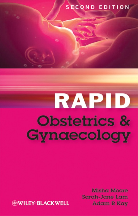 Rapid Obstetrics and Gynaecology, 2nd Edition - FULL INSTANT DOWNLOAD | PDF DOCX EPUB