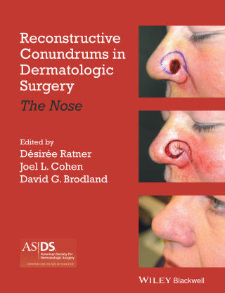 Titelbild: Reconstructive Conundrums in Dermatologic Surgery 1st edition 9781118272329