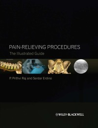 Cover image: Pain-Relieving Procedures: The Illustrated Guide 1st edition 9780470670385