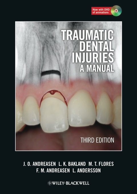 Traumatic Dental Injuries: A Manual, 3rd Edition - FULL INSTANT DOWNLOAD | PDF DOCX EPUB