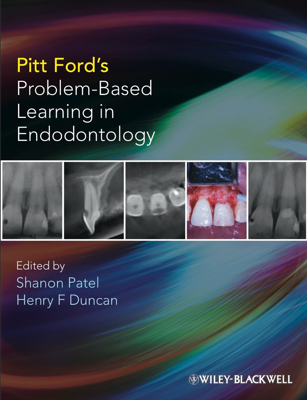 Pitt Ford’s Problem-Based Learning in Endodontology 1st Edition