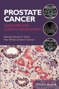 Cover image: Prostate Cancer 1st edition 9781118347355